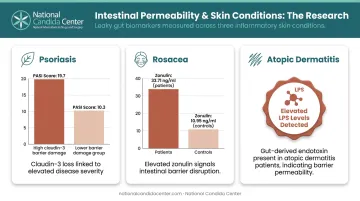 Leaky gut intestinal permeability statistics across psoriasis rosacea and atopic dermatitis