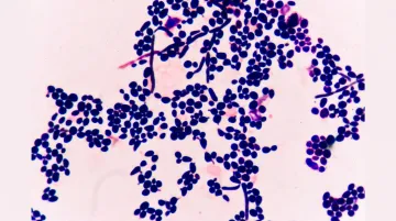 Microscopic view of Candida albicans fungal cells under laboratory conditions