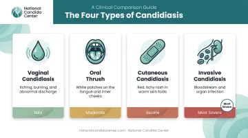 Four types of candidiasis symptoms and severity comparison chart