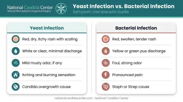 Yeast infection versus bacterial belly button infection side-by-side comparison chart