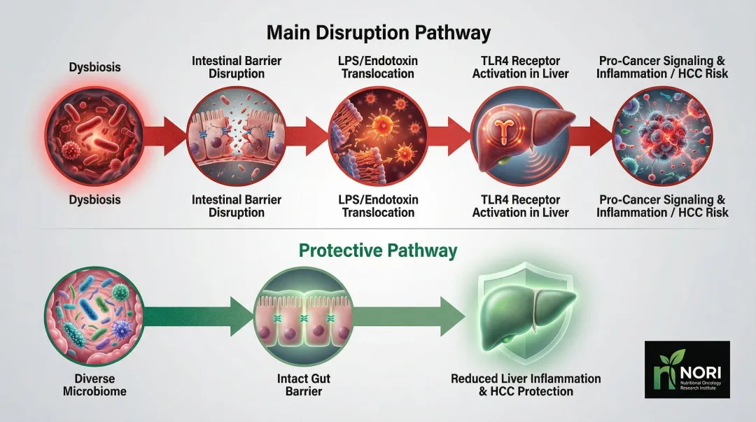 Gut-liver axis dysbiosis pathway driving hepatocellular carcinoma risk diagram