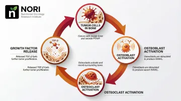 Bone metastasis vicious cycle diagram showing tumor cells osteoclast activation and bone destruction loop