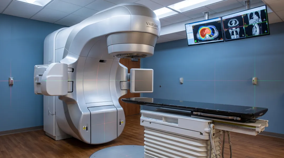 SBRT stereotactic body radiation therapy linear accelerator machine in clinical setting