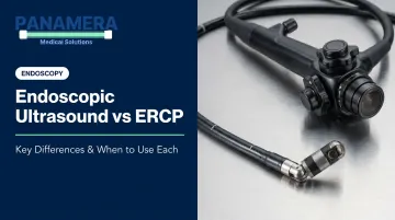 Endoscopic Ultrasound vs ERCP: Key Differences & When to Use Each