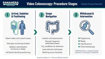 Video colonoscopy three-step procedure process from sedation to withdrawal and intervention
