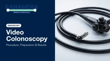 Video Colonoscopy: Procedure, Preparation & Results