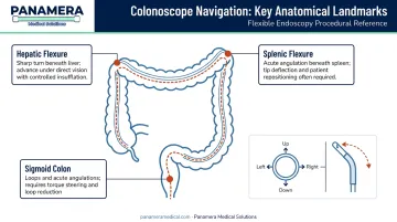 Fiberoptic colonoscope four-way tip deflection navigating sigmoid splenic and hepatic colon curves