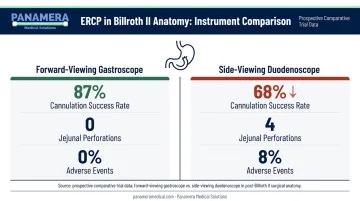 Duodenoscope versus gastroscope cannulation success rates in Billroth II anatomy comparison