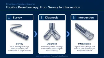 Three-stage flexible bronchoscopy procedural sequence from survey to intervention