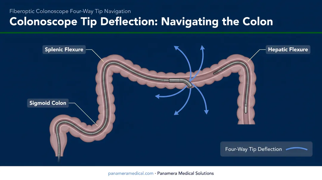 Fiberoptic colonoscope four-way tip deflection navigating sigmoid splenic and hepatic colon curves
