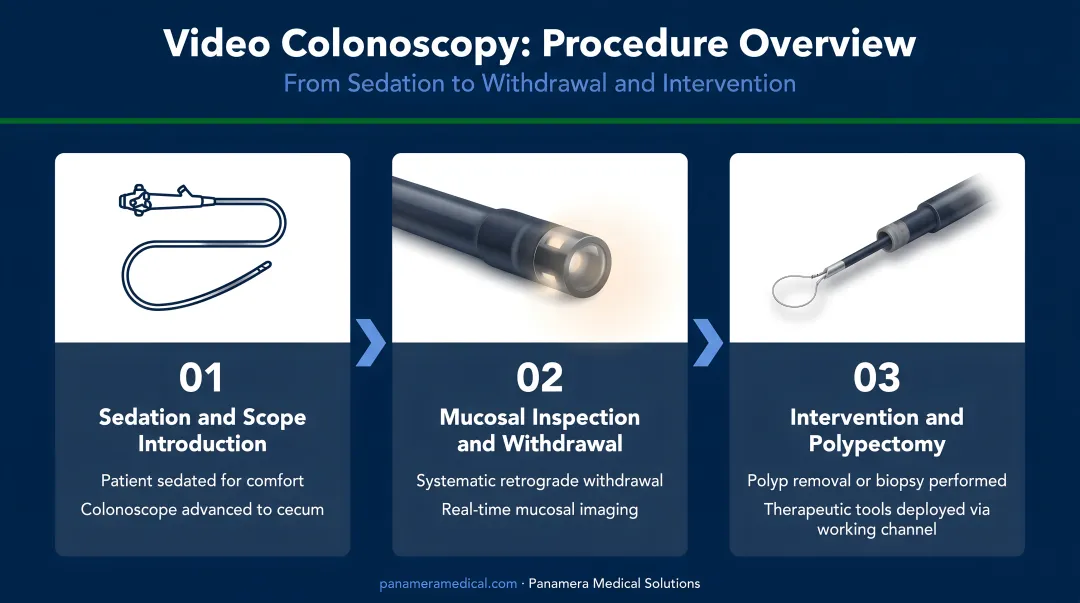 Video colonoscopy three-step procedure process from sedation to withdrawal and intervention