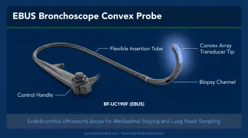 EBUS bronchoscope convex probe equipment displayed in clinical endoscopy suite