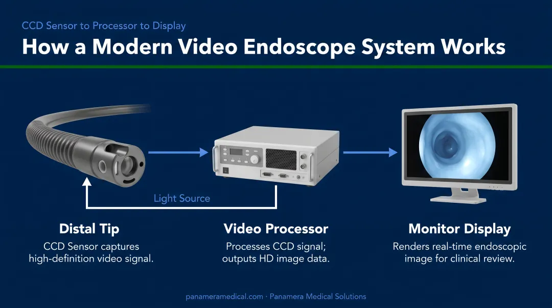 Modern video endoscope system showing CCD sensor distal tip connected to processor monitor display