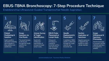 7-step EBUS-TBNA bronchoscopy procedure technique sequential process flow