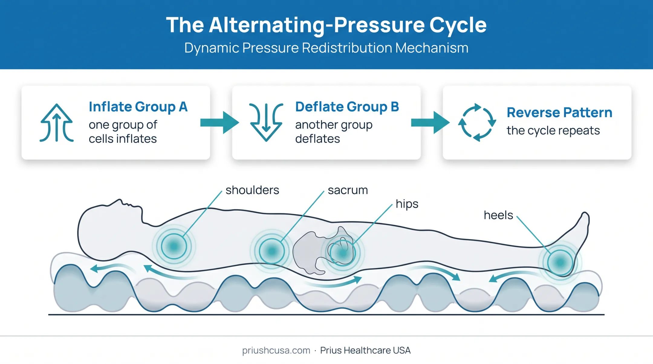 Alternating air-cell mattress pressure redistribution cycle diagram