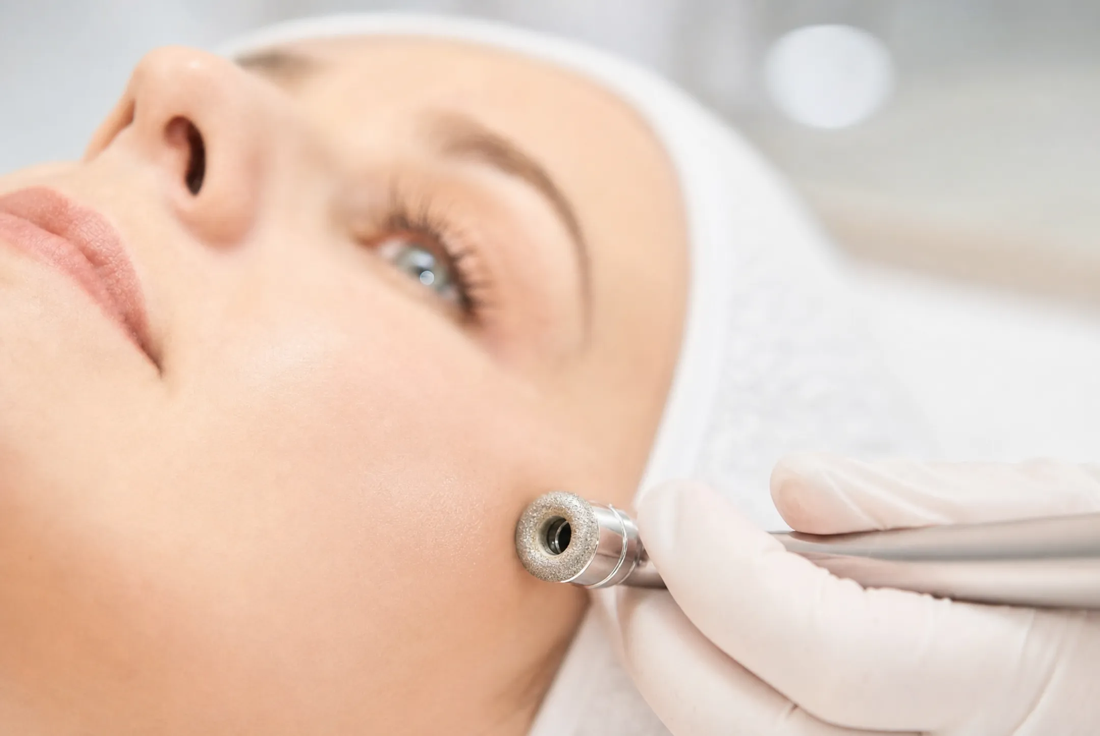 Diamond-tip microdermabrasion device treating client's cheek during facial procedure