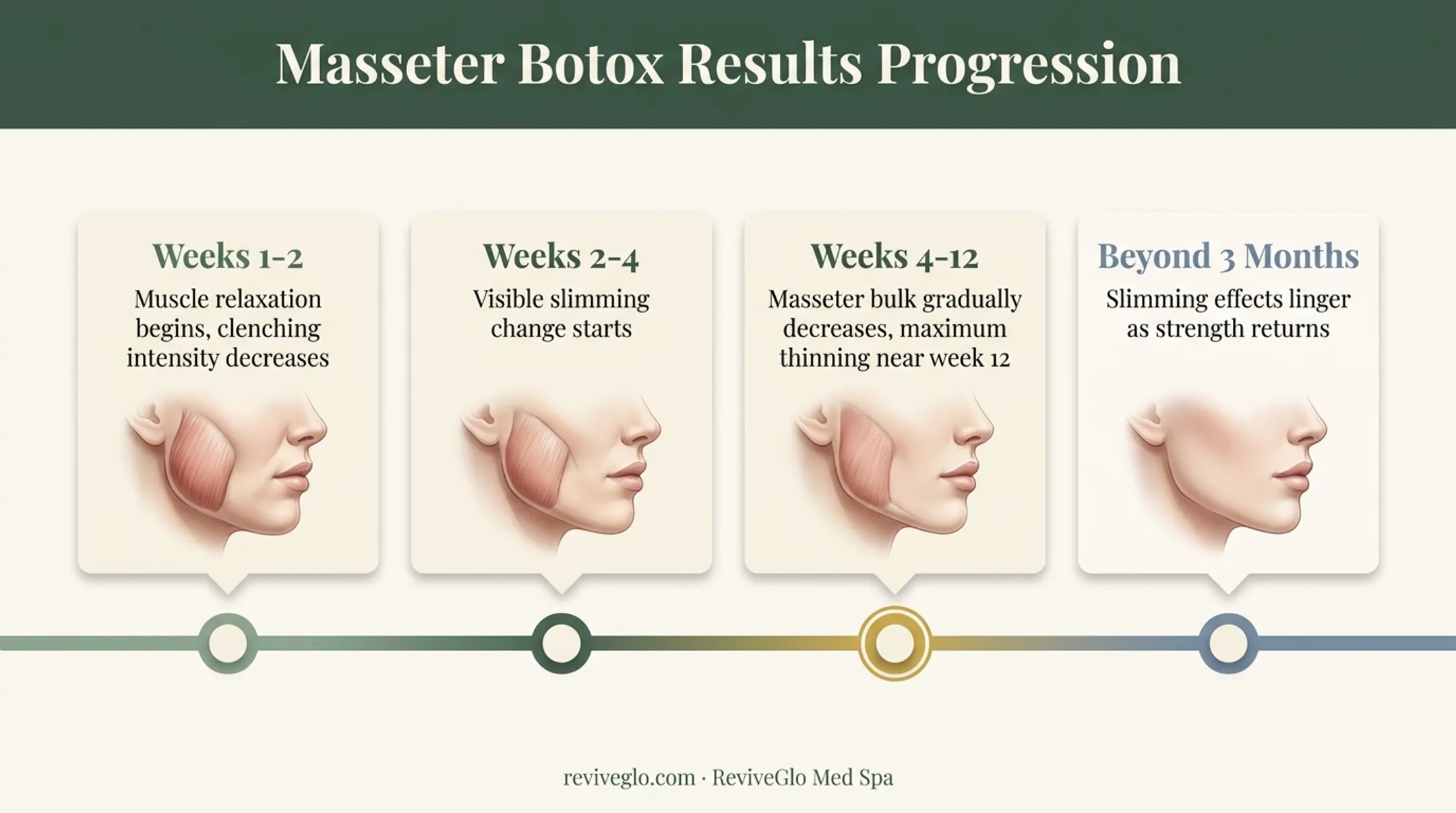 Masseter Botox results timeline from week one to three months