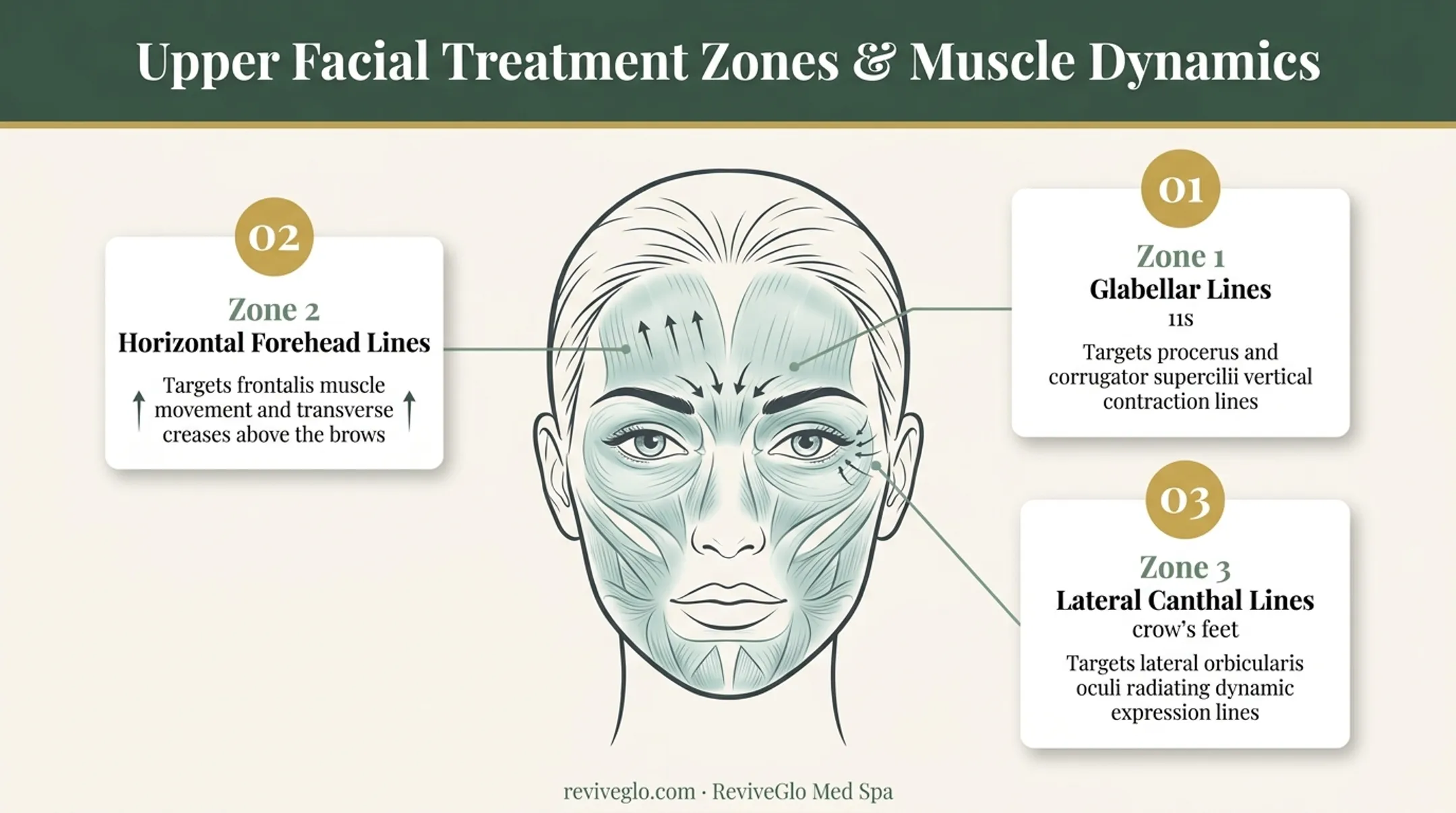 FDA-approved Botox treatment areas glabellar forehead and crow's feet lines