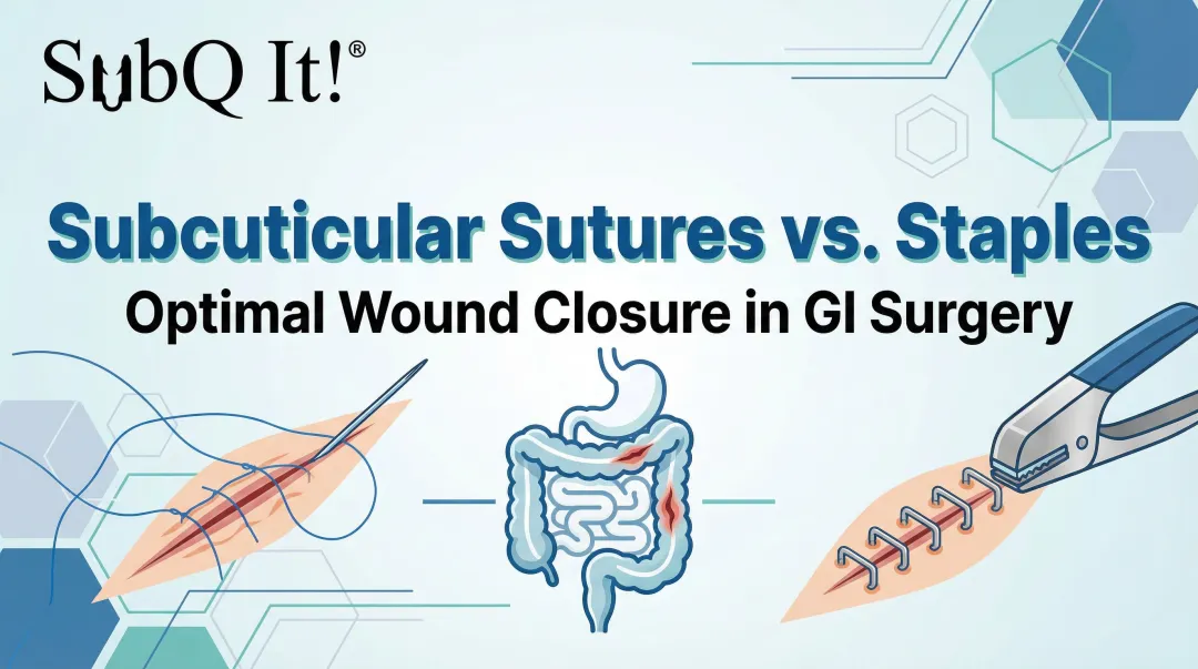 Cover image for Subcuticular Sutures vs. Staples: Optimal Wound Closure in GI Surgery