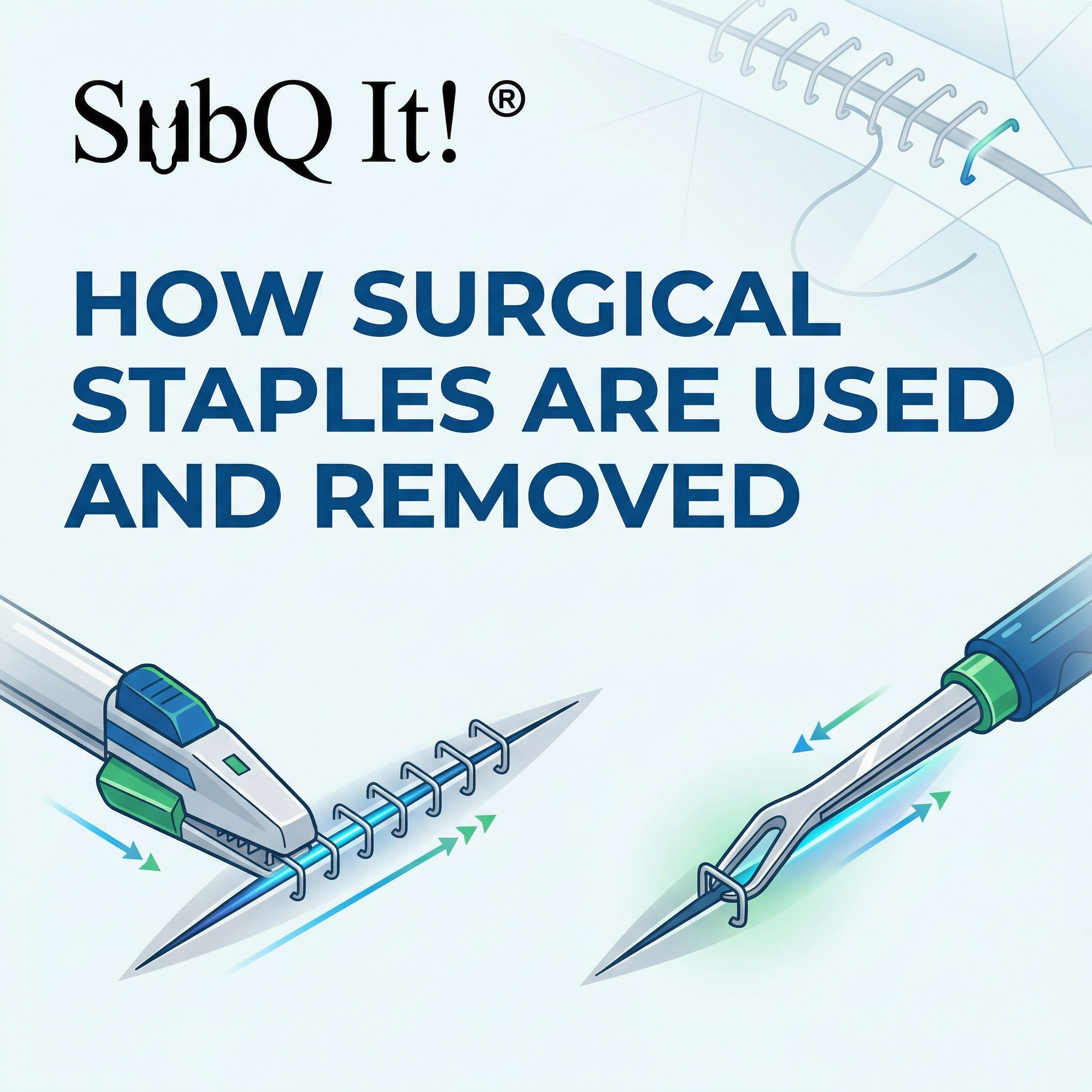 How Surgical Staples Are Used and Removed