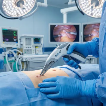 Laparoscopic Surgery