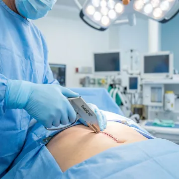 General & Abdominal Surgery