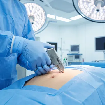 Minimally Invasive & Laparoscopic Surgery