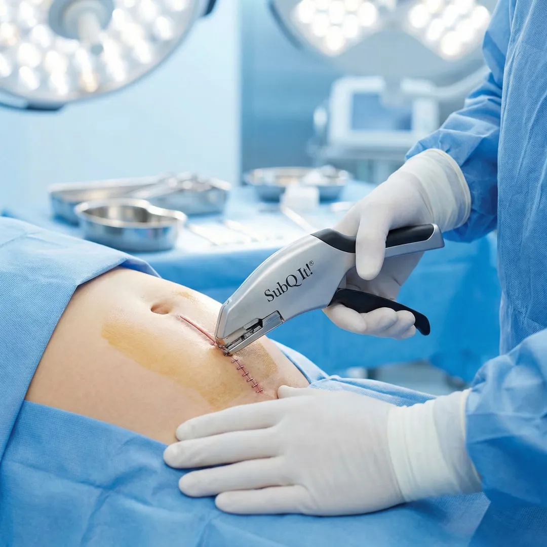 Gynecologic Surgery