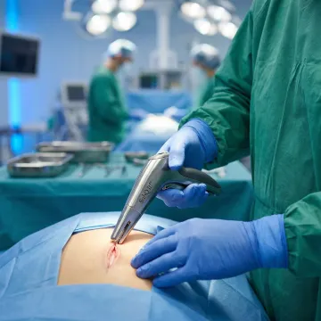 General & Abdominal Surgery