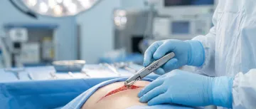 Plastic & Reconstructive Surgery