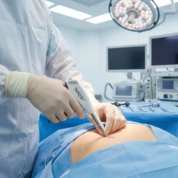 Minimally Invasive Surgery