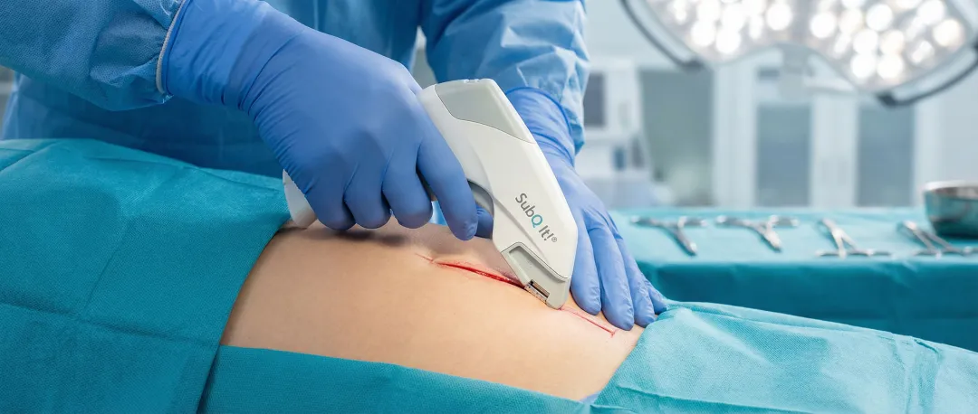 Gynecologic Surgery