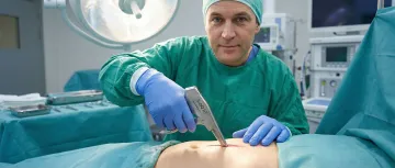 Abdominal & General Surgery