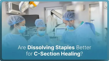Why Are Dissolving Staples Better for C-Section Healing?