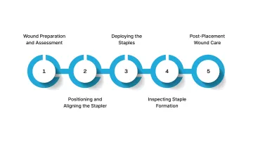 5 Steps to Take for Placing Surgical Staples Effectively