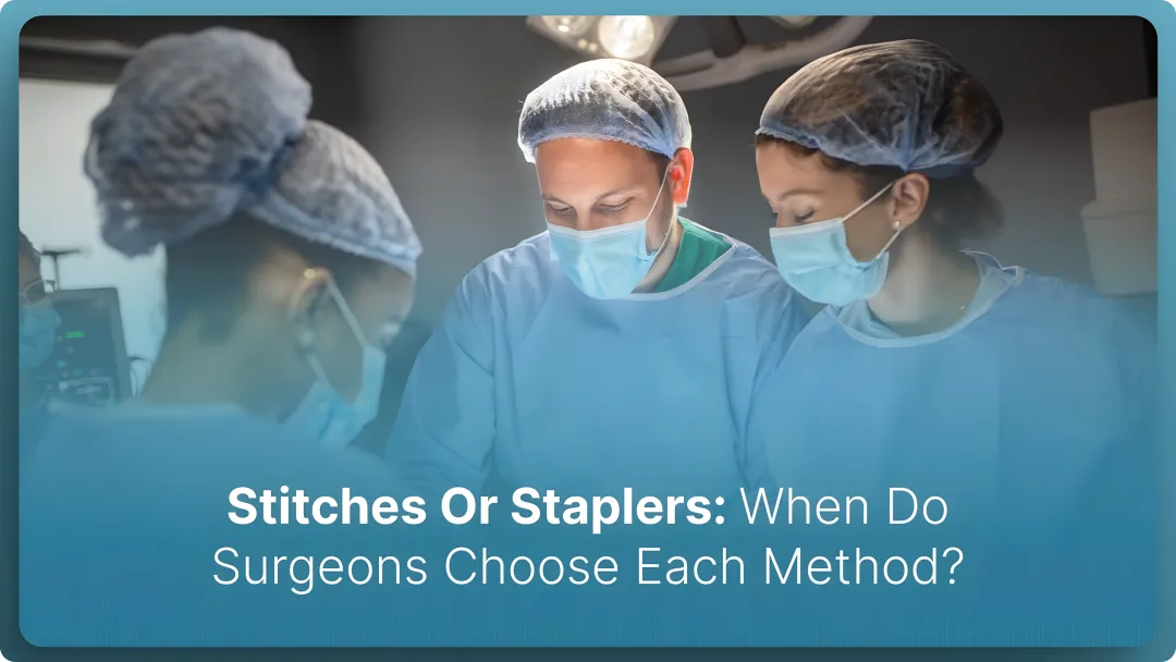 Stitches Or Staplers: When Do Surgeons Choose Each Method? (2026)