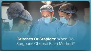 Stitches Or Staplers: When Do Surgeons Choose Each Method? (2026)