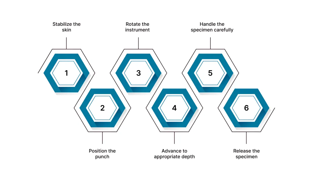Biopsy procedure