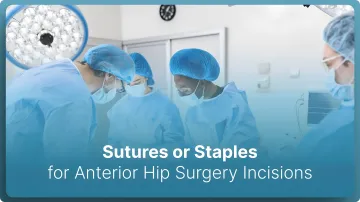 Sutures or Staples for Anterior Hip Surgery Incisions in 2026