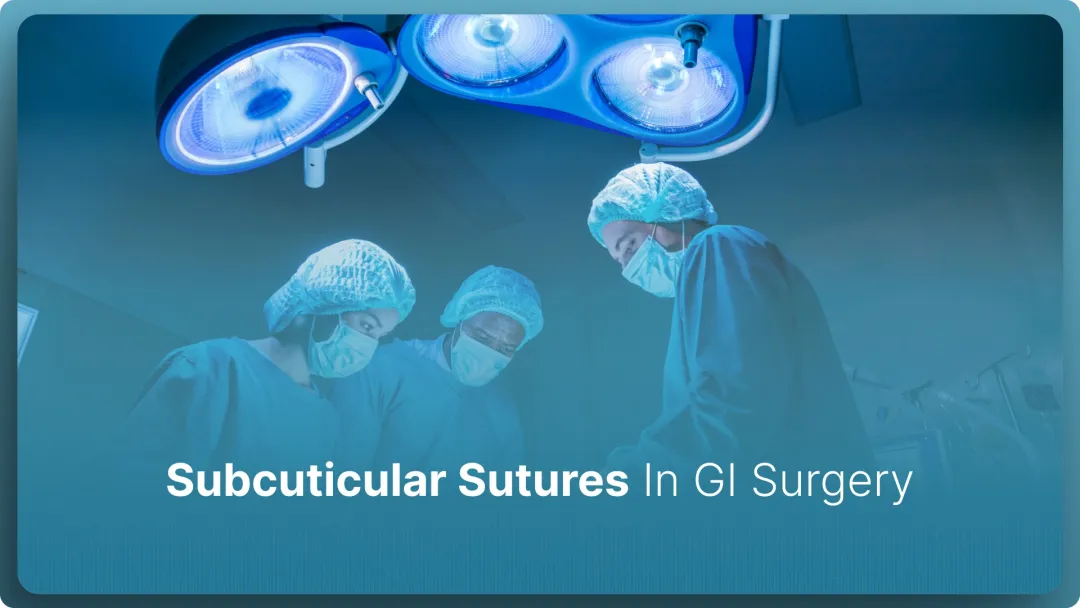 Subcuticular Sutures In GI Surgery: Are They Best in 2026?