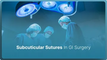 Subcuticular Sutures In GI Surgery: Are They Best in 2026?