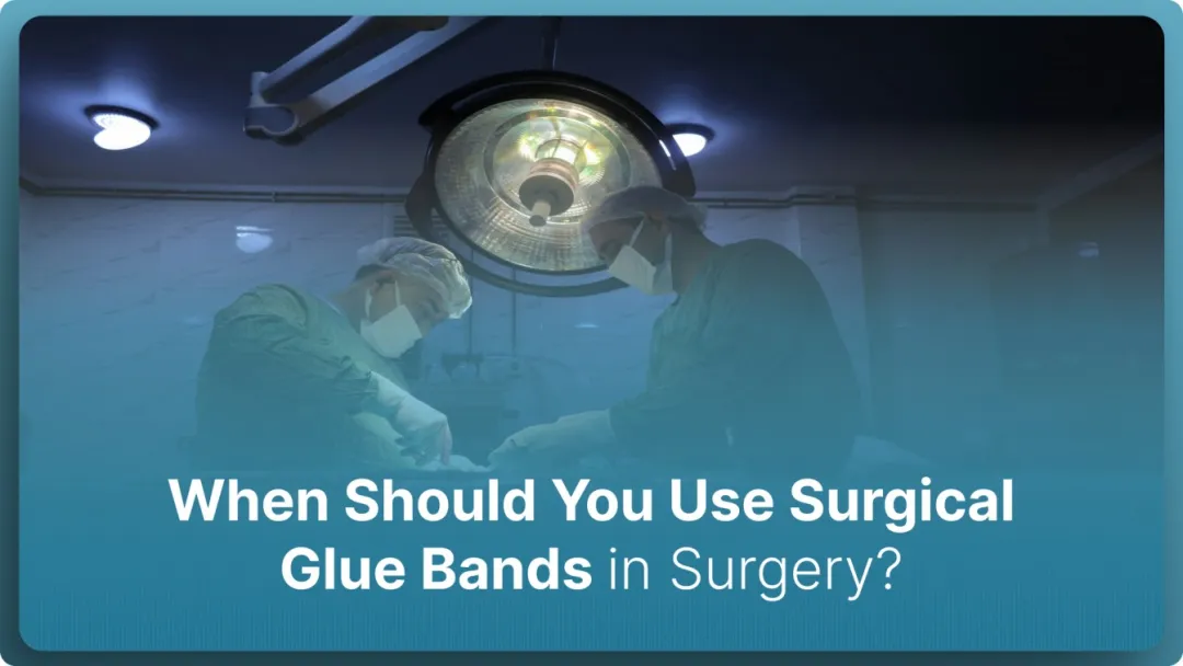 When Should You Use Surgical Glue Bands in Surgery? (2026)