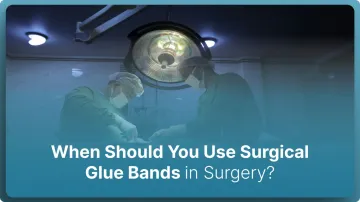 When Should You Use Surgical Glue Bands in Surgery? (2026)