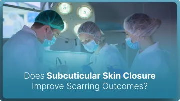 Does Subcuticular Skin Closure Improve Scarring Outcomes? (2026)