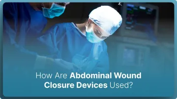 How Are Abdominal Wound Closure Devices Used in 2026?
