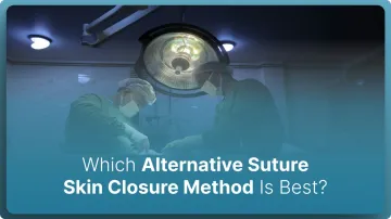Which Alternative Suture Skin Closure Method Is Best? (2026)