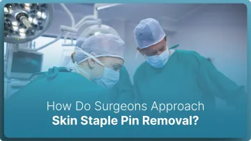 How Do Surgeons Approach Skin Staple Pin Removal in 2026?