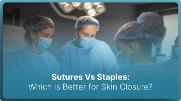 Sutures Vs Staples: Which is Better for Skin Closure? (2026)