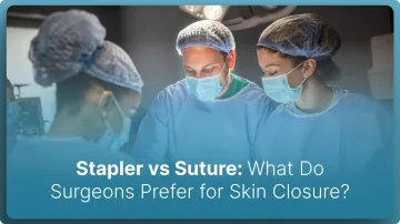 Stapler vs Suture: What Do Surgeons Prefer for Skin Closure? (2026)