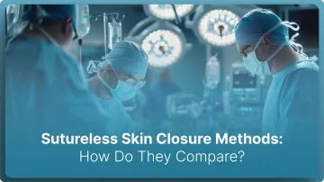 Sutureless Skin Closure Methods: How Do They Compare? (2026)